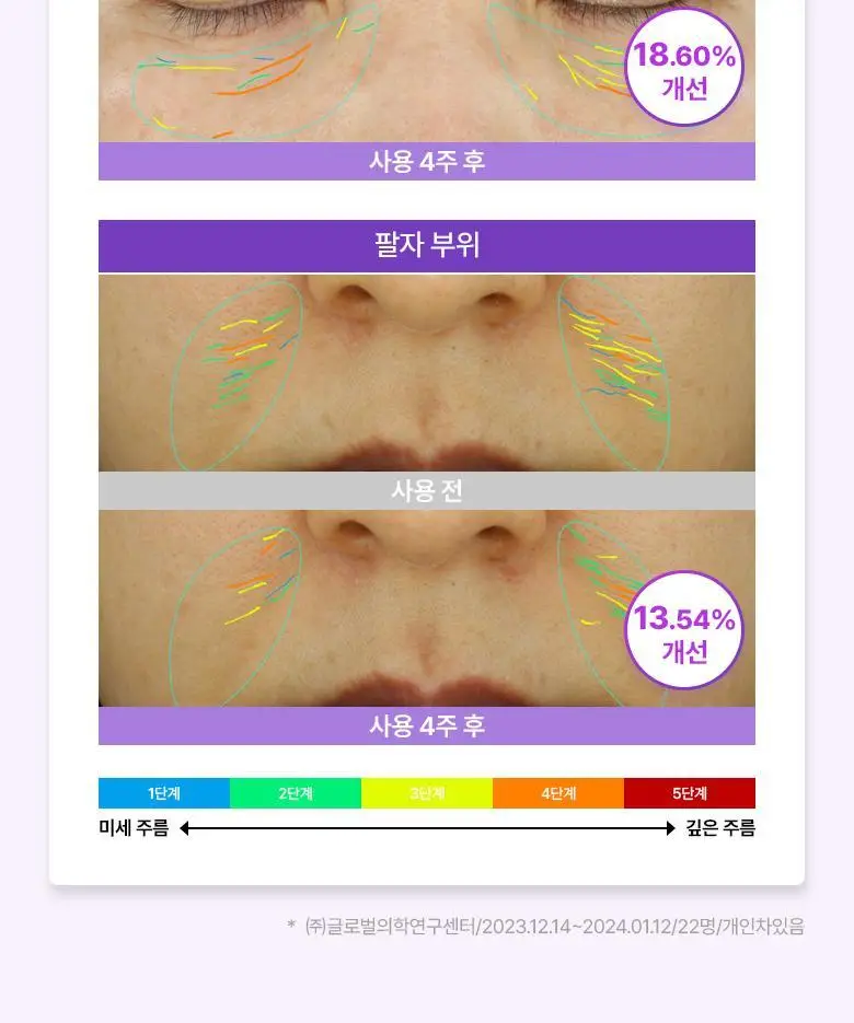 [눈가탄력케어] 바이오힐 보 프로바이오덤 3D 리프팅 아이&링클 크림 25ml (기획) 상세페이지 15